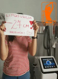 liposukcja
